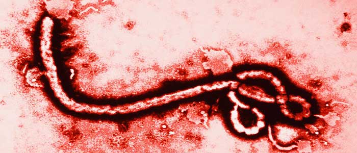 Ebola Virüsü Nedir?